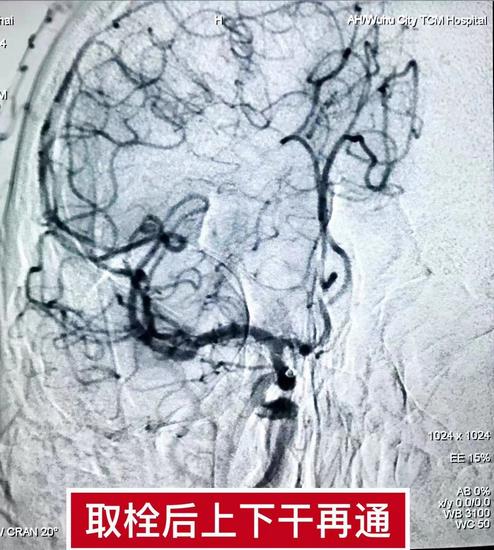 搶抓黃金救治時間  疏通血管為生命續(xù)航(圖2)