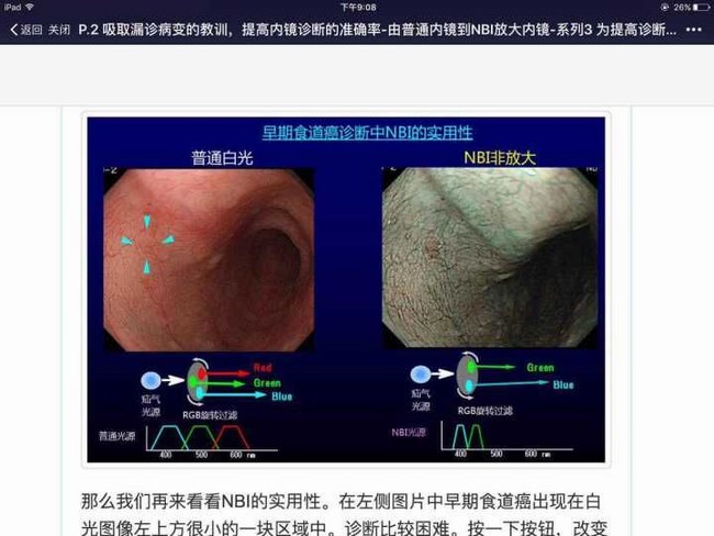 國(guó)際一流胃腸內(nèi)窺鏡系統(tǒng)助力我院鏡診療水平更上新的臺(tái)階(圖1)